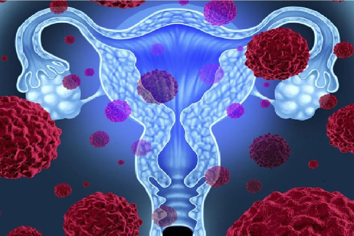 Cáncer cervicouterino: Cuál es la edad sugerida para tomarse exámenes y cómo prevenir el VPH