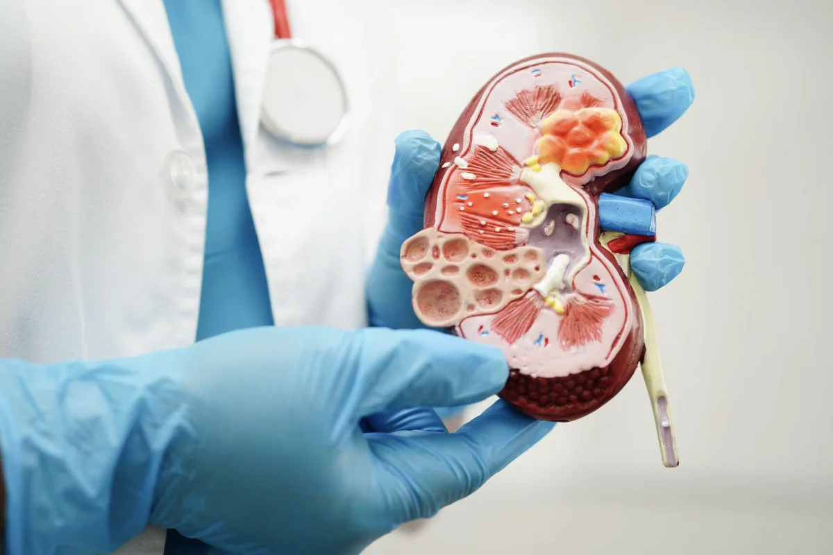 Cáncer de riñón en aumento: A qué edad se desarrolla y cuáles son los 6 síntomas que no debes ignorar