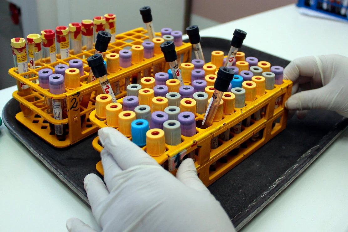 Hombre de 60 años muere por virus Hanta en Limache: Autoridad sanitaria realiza investigación epidemiológica