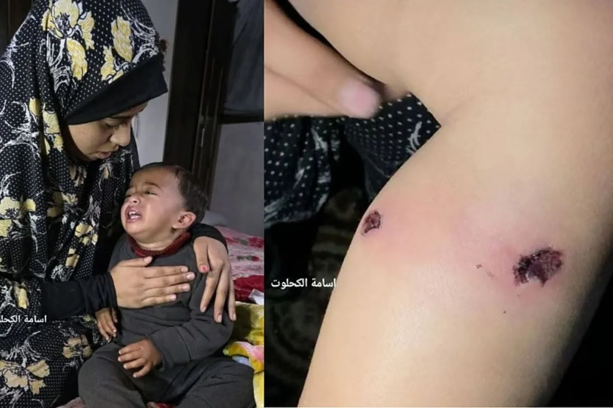 Soldados israelíes torturaron a bebé palestino con cigarros para obligar a padre a confesar y ONU pide a países tomar acciones