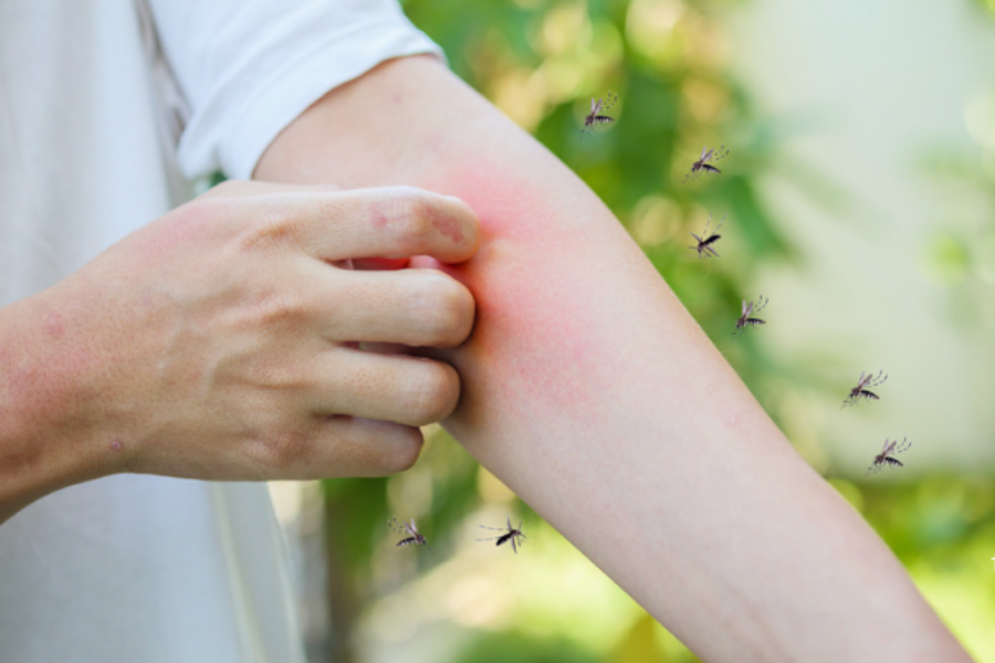 ¿Está Chile preparado para una brote de dengue?: Cambio climático pone al país en desventaja